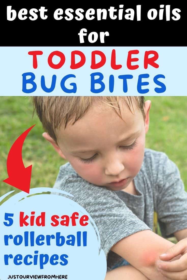 essential oils for toddler bug bites